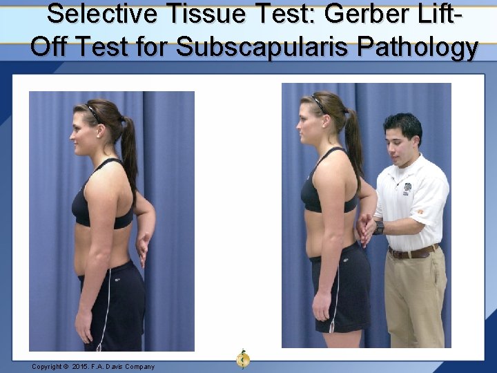 Selective Tissue Test: Gerber Lift. Off Test for Subscapularis Pathology Copyright © 2015. F.