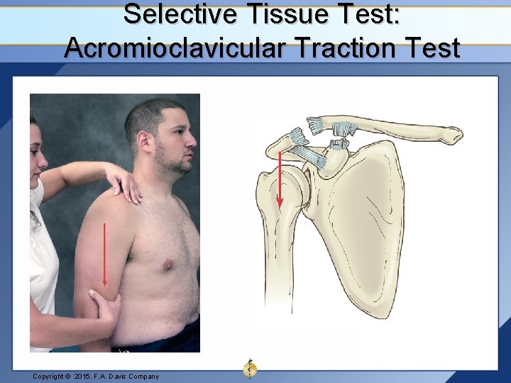 Selective Tissue Test: Acromioclavicular Traction Test Copyright © 2015. F. A. Davis Company 