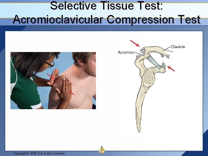 Selective Tissue Test: Acromioclavicular Compression Test Copyright © 2015. F. A. Davis Company 