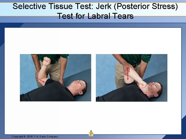 Selective Tissue Test: Jerk (Posterior Stress) Test for Labral Tears Copyright © 2015. F.