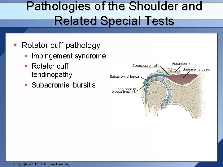 Pathologies of the Shoulder and Related Special Tests § Rotator cuff pathology § Impingement