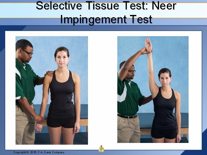 Selective Tissue Test: Neer Impingement Test Copyright © 2015. F. A. Davis Company 