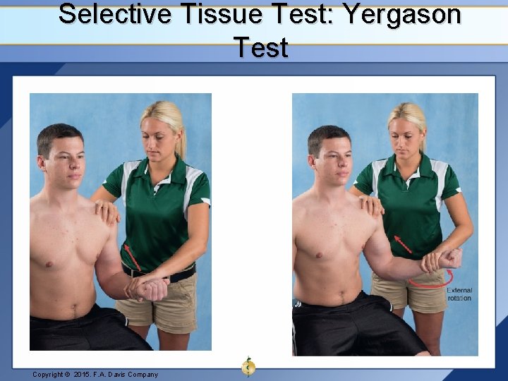 Selective Tissue Test: Yergason Test Copyright © 2015. F. A. Davis Company 