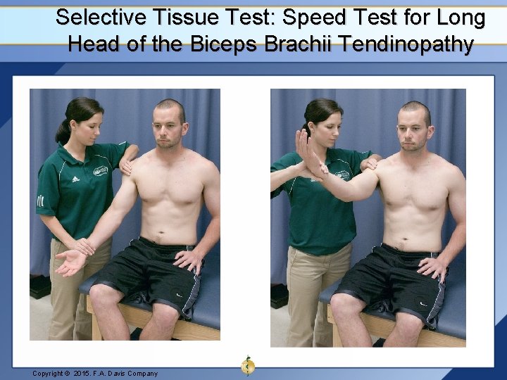 Selective Tissue Test: Speed Test for Long Head of the Biceps Brachii Tendinopathy Copyright