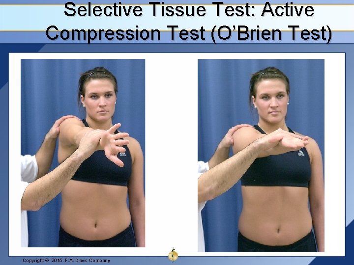Selective Tissue Test: Active Compression Test (O’Brien Test) Copyright © 2015. F. A. Davis