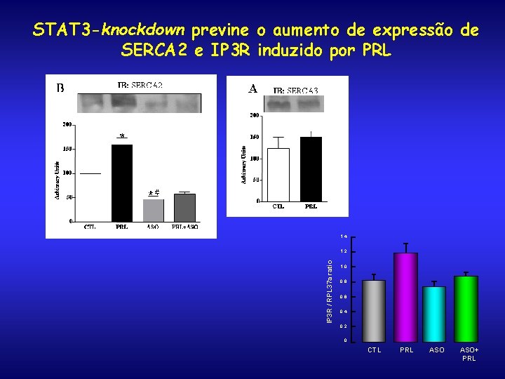 STAT 3 -knockdown previne o aumento de expressão de SERCA 2 e IP 3