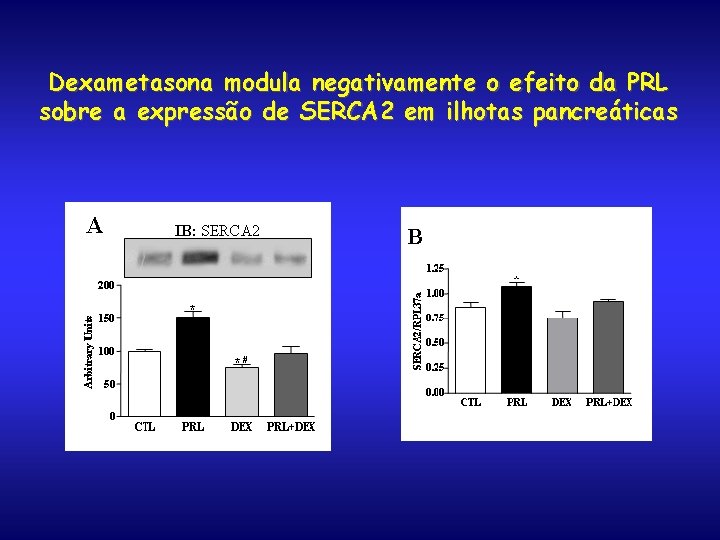 Dexametasona modula negativamente o efeito da PRL sobre a expressão de SERCA 2 em