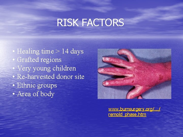 RISK FACTORS • Healing time > 14 days • Grafted regions • Very young