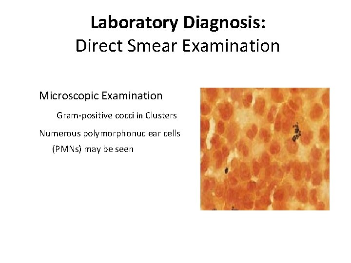 Laboratory Diagnosis: Direct Smear Examination Microscopic Examination Gram-positive cocci in Clusters Numerous polymorphonuclear cells