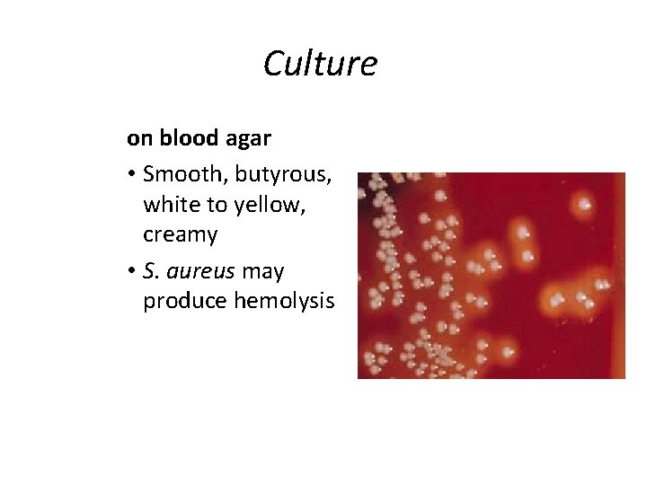 Culture on blood agar • Smooth, butyrous, white to yellow, creamy • S. aureus