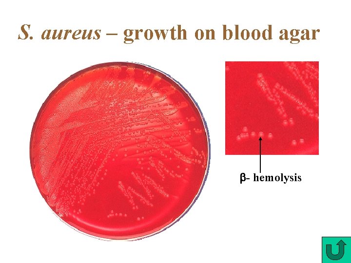 S. aureus – growth on blood agar - hemolysis 