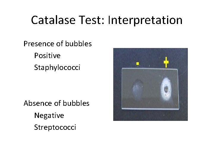 Catalase Test: Interpretation Presence of bubbles Positive Staphylococci Absence of bubbles Negative Streptococci 