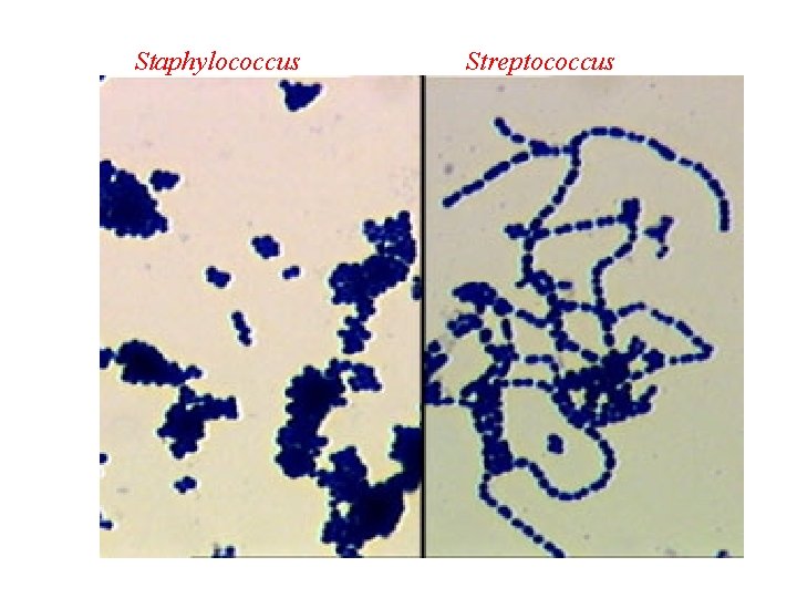 Staphylococcus Streptococcus 