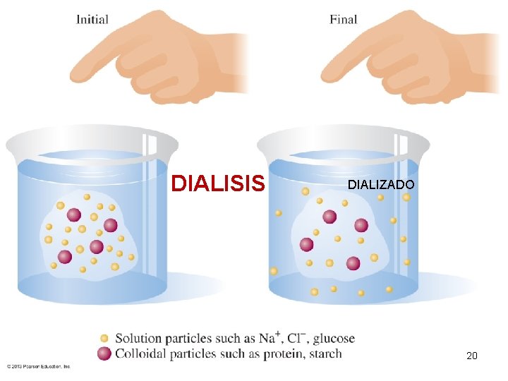 DIALISIS DIALIZADO 20 