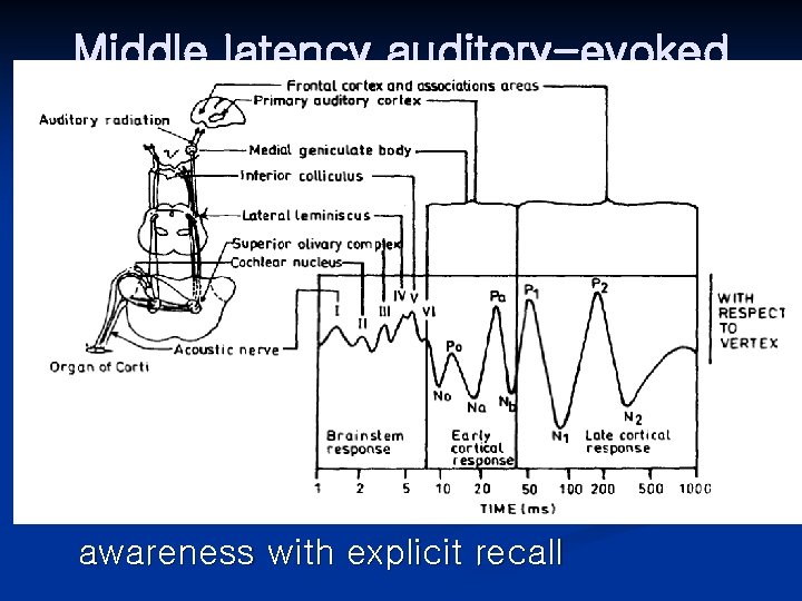 Middle latency auditory-evoked potential (MLAEP) Unconscious processing of auditory information and implicit memory of