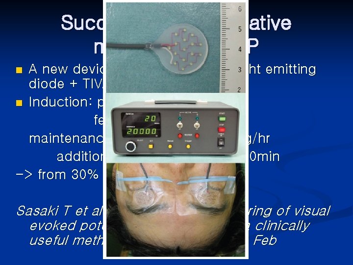Successful intraoperative monitoring of VEP A new device using high power light emitting diode