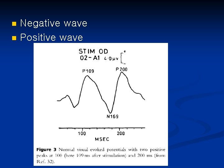 Negative wave n Positive wave n 