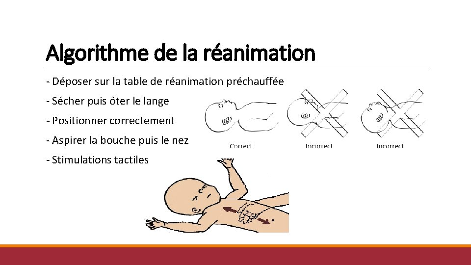 Algorithme de la réanimation - Déposer sur la table de réanimation préchauffée - Sécher Algorithme de la réanimation - Déposer sur la table de réanimation préchauffée - Sécher