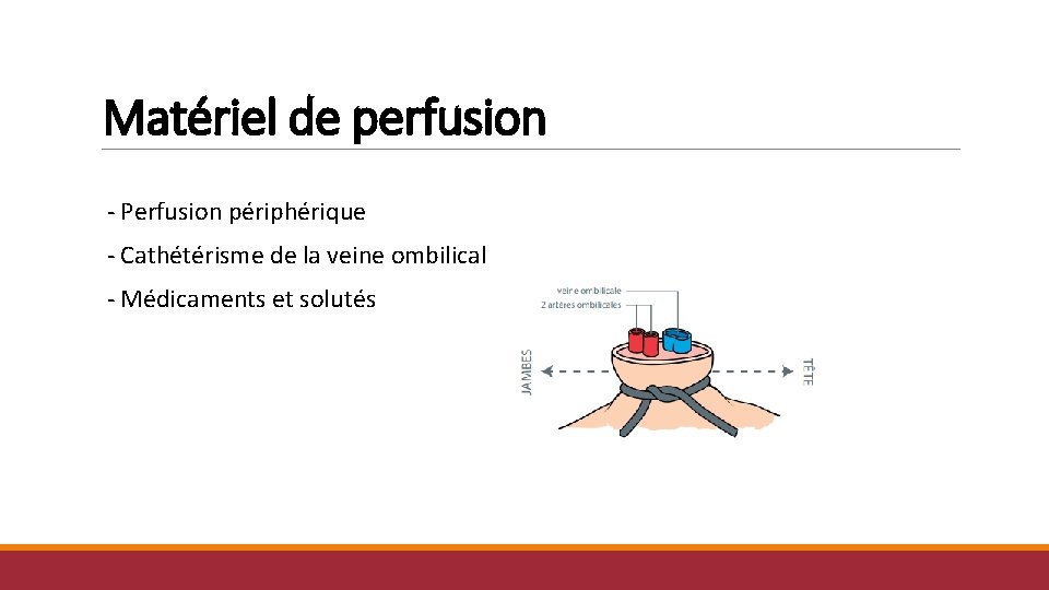 Matériel de perfusion - Perfusion périphérique - Cathétérisme de la veine ombilical - Médicaments Matériel de perfusion - Perfusion périphérique - Cathétérisme de la veine ombilical - Médicaments