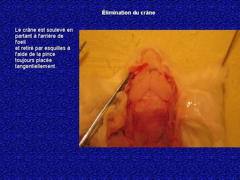 Élimination du crâne Le crâne est soulevé en partant à l'arrière de l'oeil et