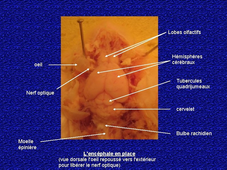 Lobes olfactifs Hémisphères cérébraux oeil Tubercules quadrijumeaux Nerf optique cervelet Bulbe rachidien Moelle épinière