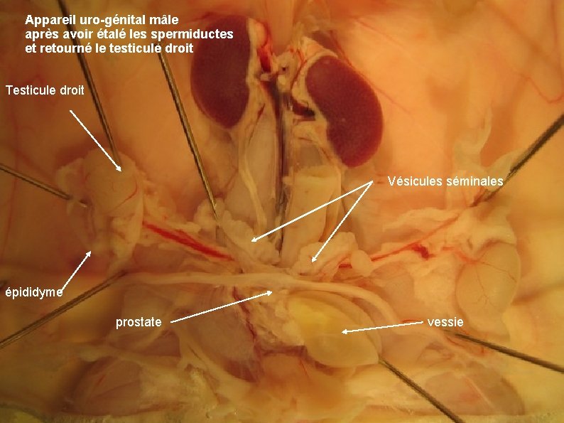 Appareil uro-génital mâle après avoir étalé les spermiductes et retourné le testicule droit Testicule