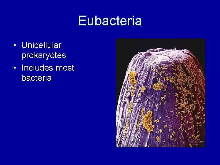 Eubacteria • Unicellular prokaryotes • Includes most bacteria 