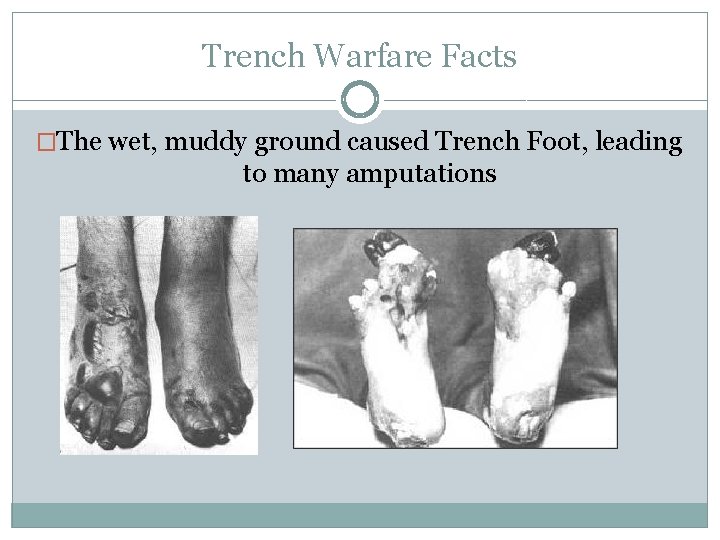 Trench Warfare Facts �The wet, muddy ground caused Trench Foot, leading to many amputations