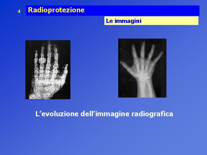 4 Radioprotezione Le immagini L’evoluzione dell’immagine radiografica 