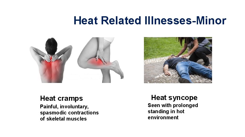 Heat Related Illnesses-Minor Heat cramps Painful, involuntary, spasmodic contractions of skeletal muscles Heat syncope Heat Related Illnesses-Minor Heat cramps Painful, involuntary, spasmodic contractions of skeletal muscles Heat syncope