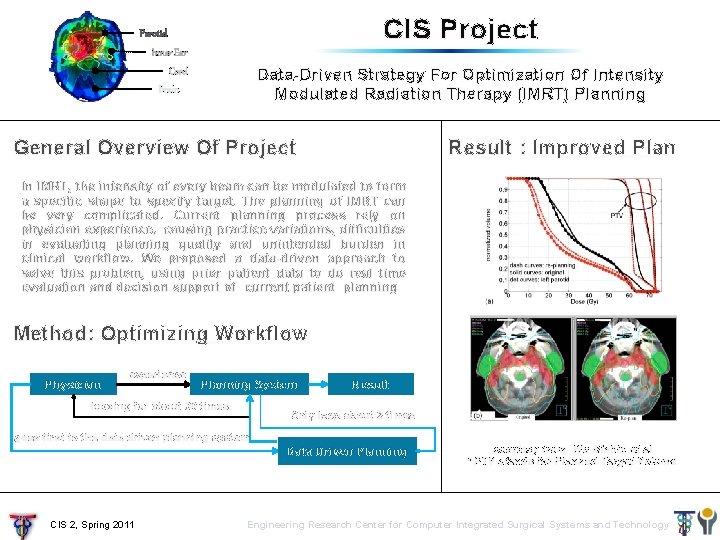 CIS Project Parotid Inner Ear Data-Driven Strategy For Optimization Of Intensity Modulated Radiation Therapy