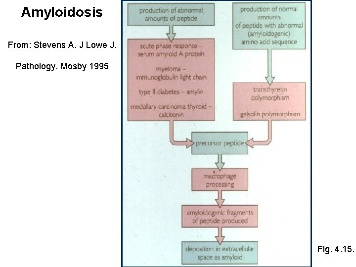 Amyloidosis From: Stevens A. J Lowe J. Pathology. Mosby 1995 Fig. 4. 15. 