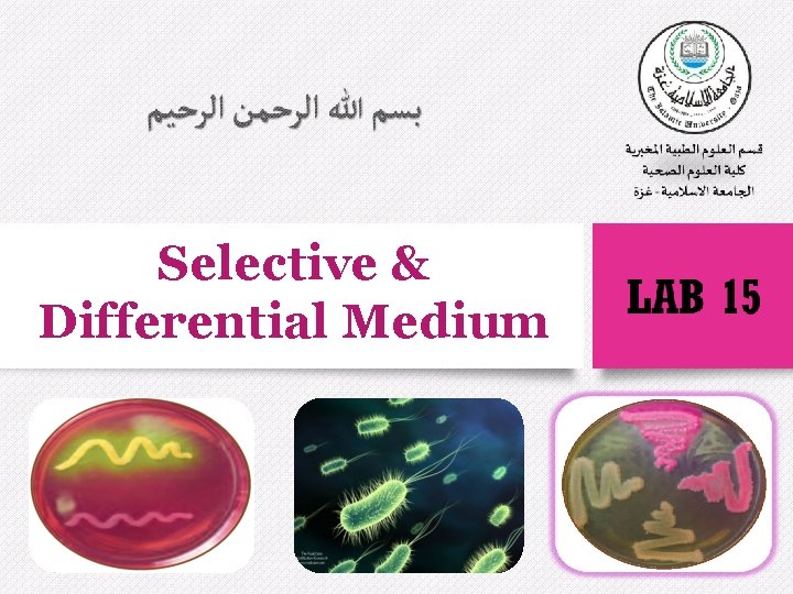Selective & Differential Medium 