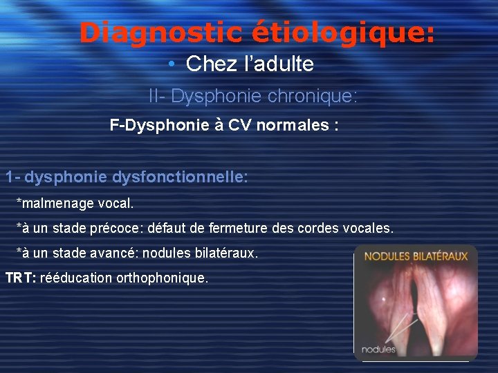 Diagnostic étiologique: • Chez l’adulte II- Dysphonie chronique: F-Dysphonie à CV normales : 1