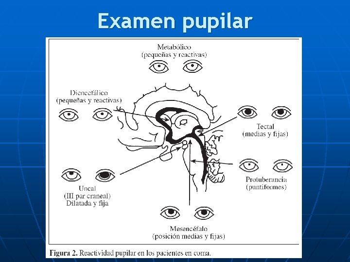 Examen pupilar 