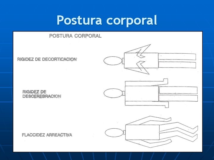 Postura corporal 