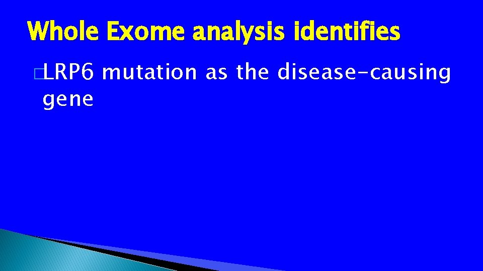Whole Exome analysis identifies �LRP 6 gene mutation as the disease-causing 