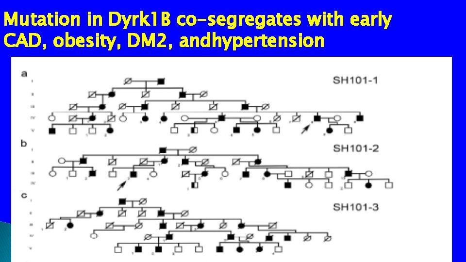 Mutation in Dyrk 1 B co-segregates with early CAD, obesity, DM 2, andhypertension 
