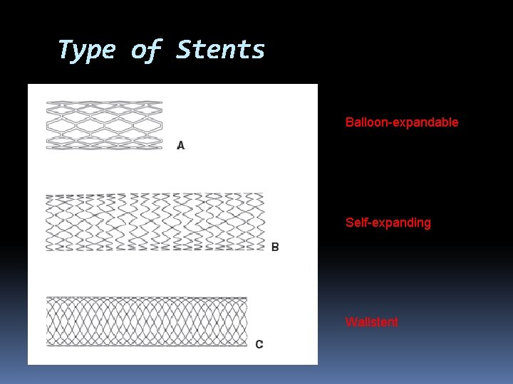 Type of Stents Balloon-expandable Self-expanding Wallstent 