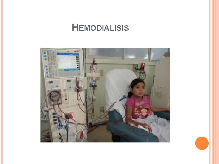 HEMODIALISIS HEMODIALISIS