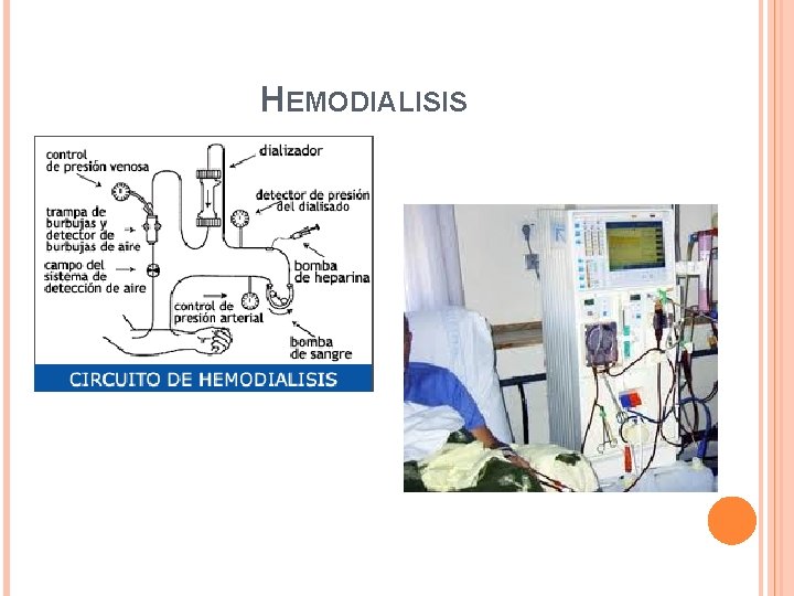 HEMODIALISIS HEMODIALISIS