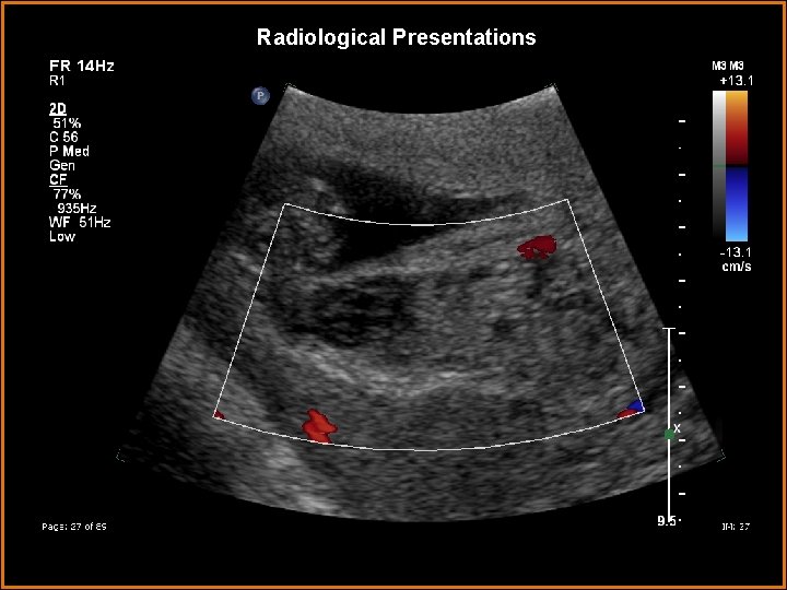 Radiological Presentations 