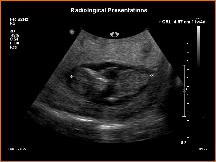 Radiological Presentations 