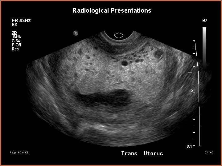 Radiological Presentations 