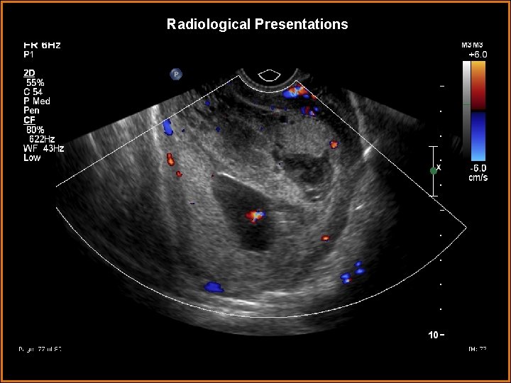 Radiological Presentations 