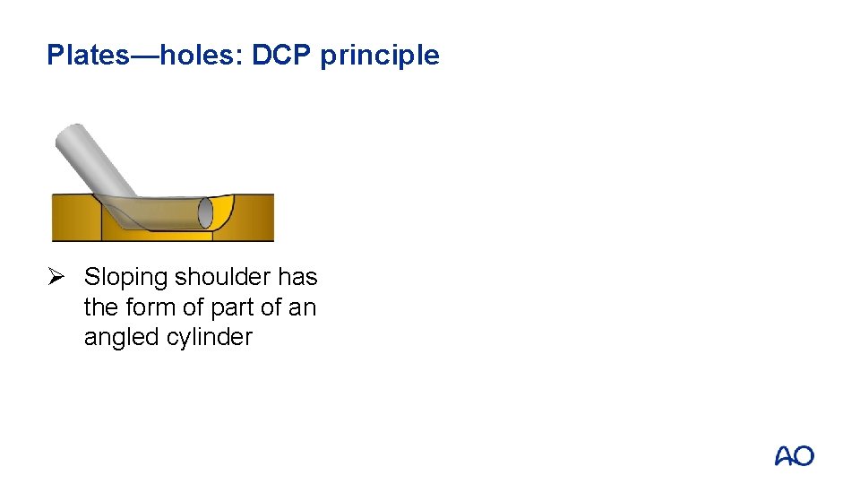 Plates—holes: DCP principle Ø Sloping shoulder has the form of part of an angled