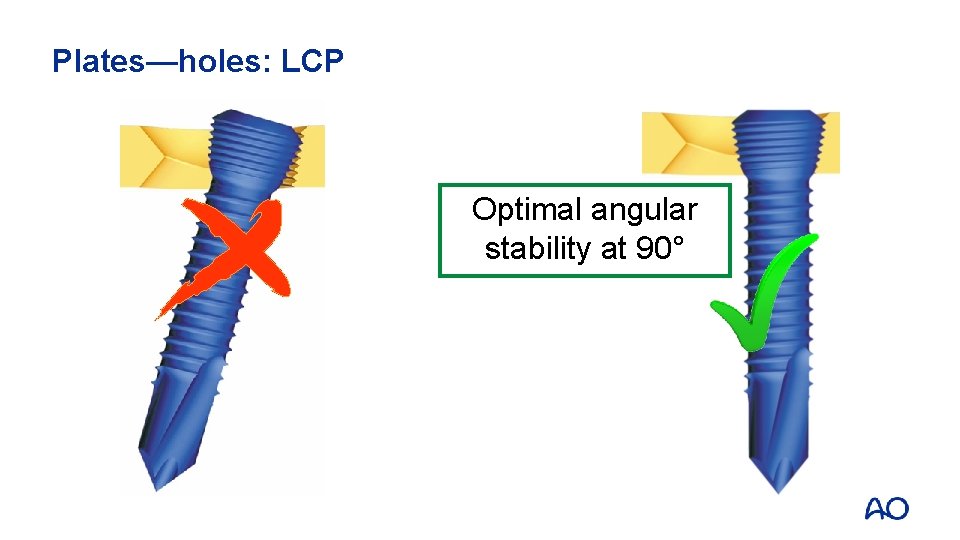Plates—holes: LCP Optimal angular stability at 90° 