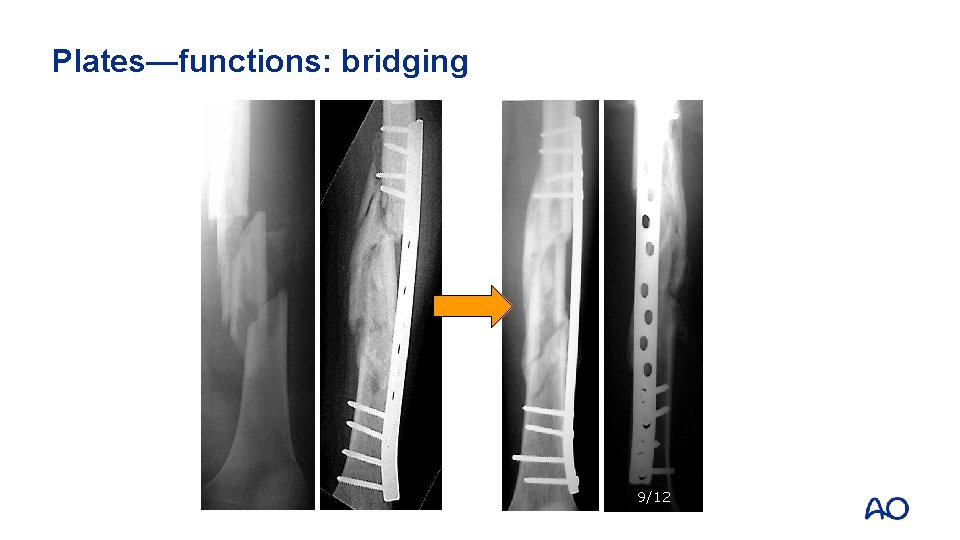 Plates—functions: bridging 9/12 
