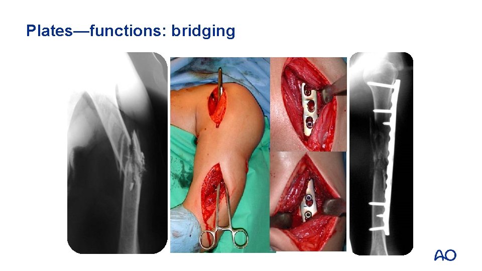Plates—functions: bridging 
