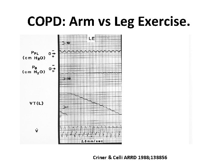 COPD: Arm vs Leg Exercise. Criner & Celli ARRD 1988; 138856 